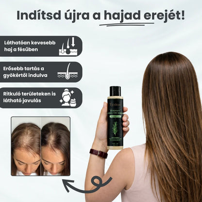 2 Hónapos Hajhullás Csökkenntő Kúra